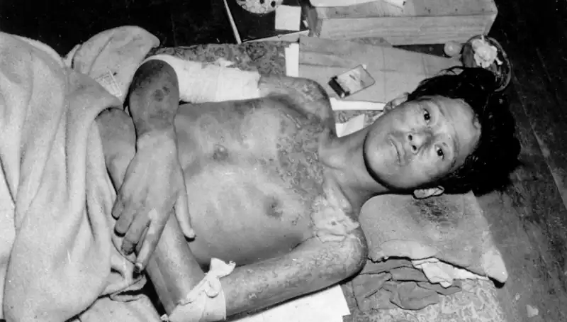 Nagasaki’den 80 Yıl Sonra Korkutucu Uyarı: Nükleer Tehdit Yeniden Gündemde