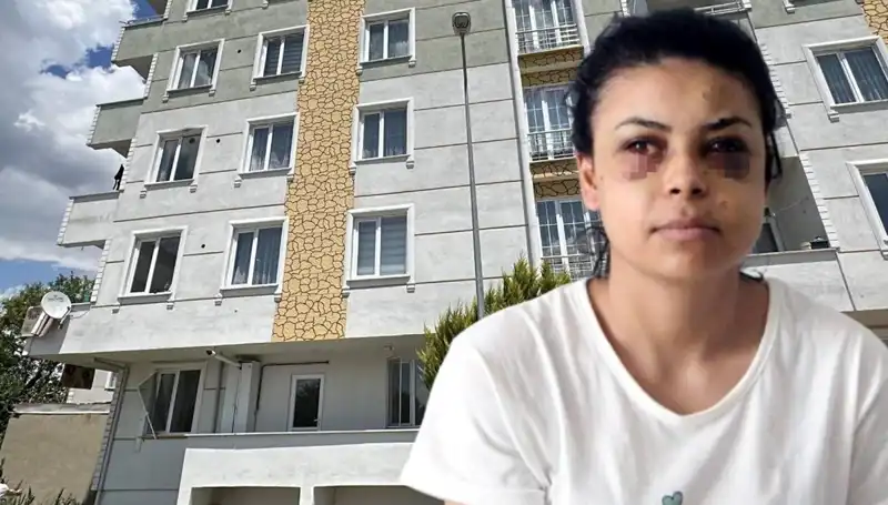 Düğün Töreninde Maganda Dehşeti: Bir Genç Kızın Gözüne Mermi Saplandı