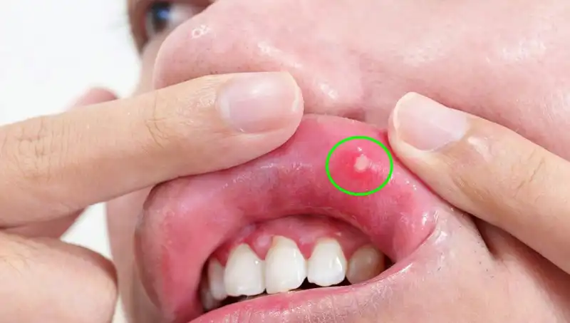 Umursamadığı Belirtiler, Kanser Tedavisinde Hayati Bir Dönüşüme Neden Oldu